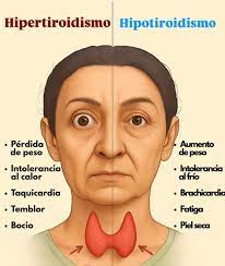 Enfermedades tiroideas como el hipotiroidismo e hipertiroidismo